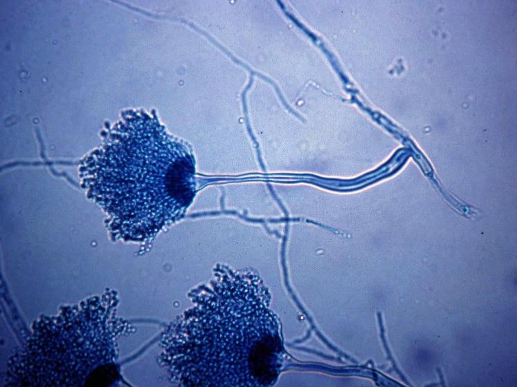 Aspergillus: The Most Dangerous Cannabis Pathogen